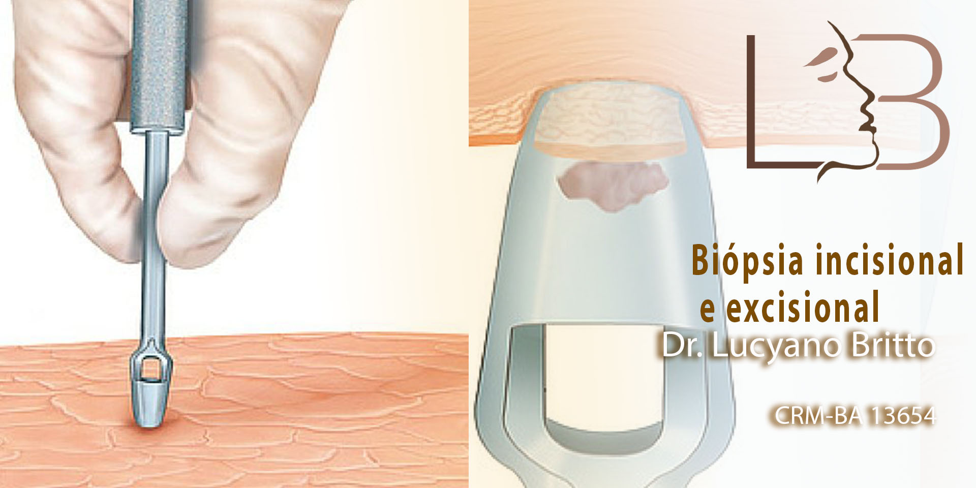 Biopsia: Algunos Tipos De Biopsia Que Se Utilizan Para, 57% OFF